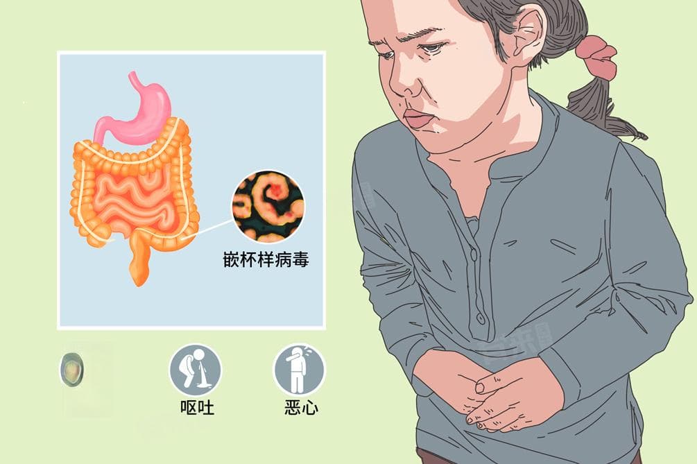 儿童诺如病毒一般几天能好