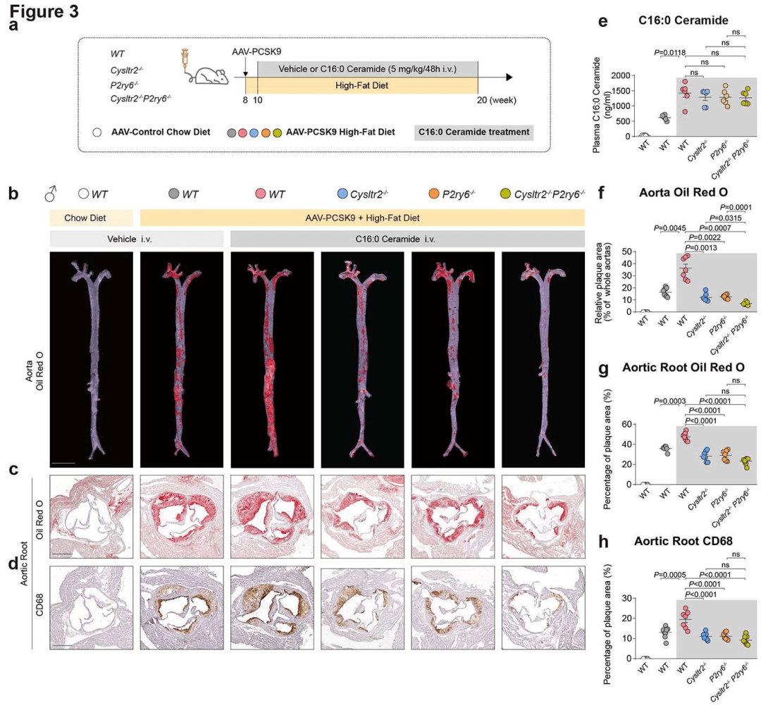 Nature最新研究：北大孔炜团队揭示神经酰胺受体调控动脉粥样硬化新机制
