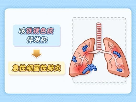 粉红色痰、铁锈色痰、脓臭痰……是怎么回事？