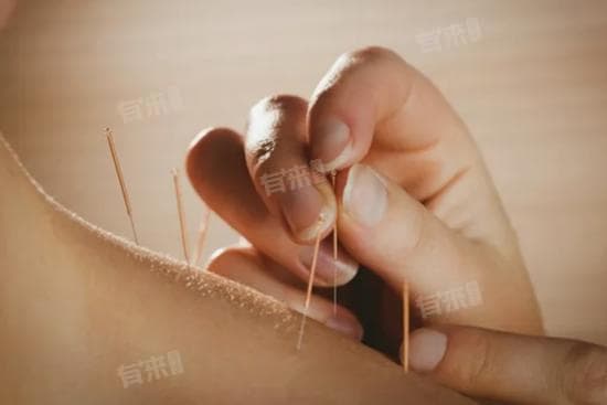 针灸是泄气还是补气