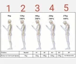 提高“颈”惕！这样做才能判断和处理颈部疼痛丨春节健身处方