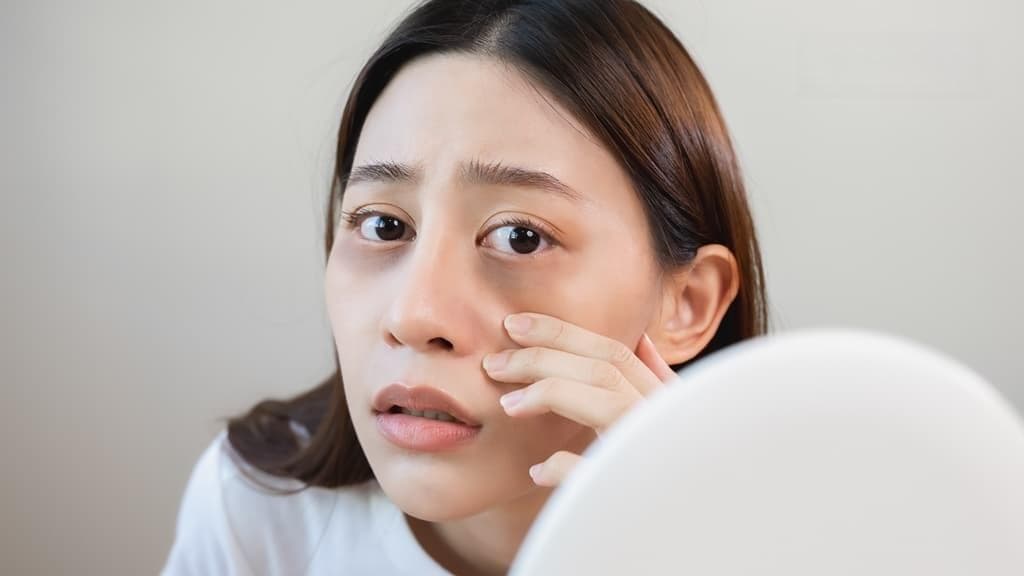 过敏产生黑眼圈怎么办？营养师教你这样吃消除黑眼圈 快速年轻10岁