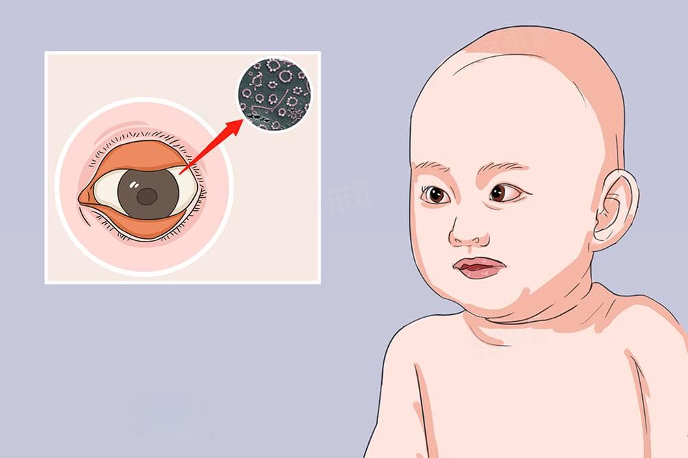 宝宝下眼睑发红是什么原因