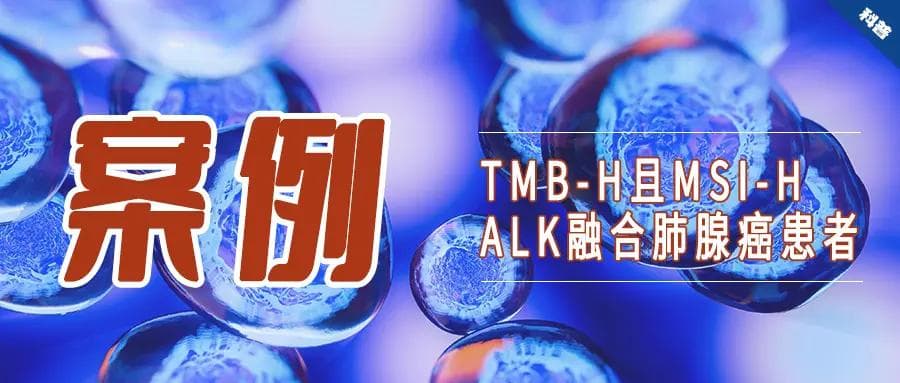 案例报道：TMB-H且MSI-H的ALK融合肺腺癌患者的长期生存