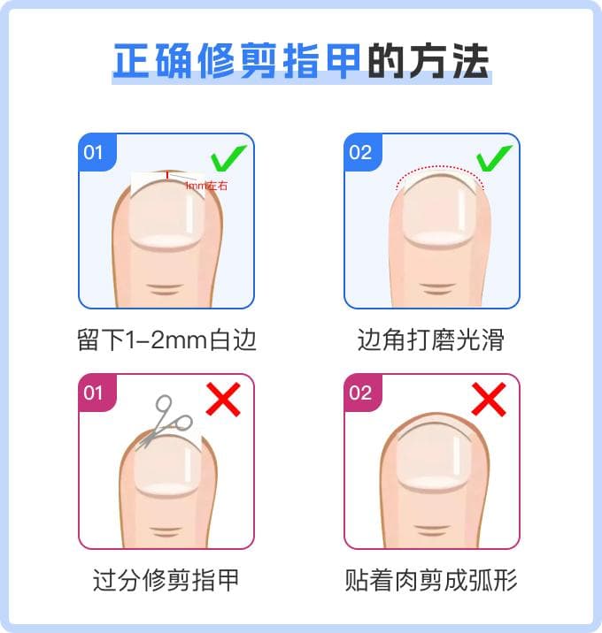 甲沟炎怎么治