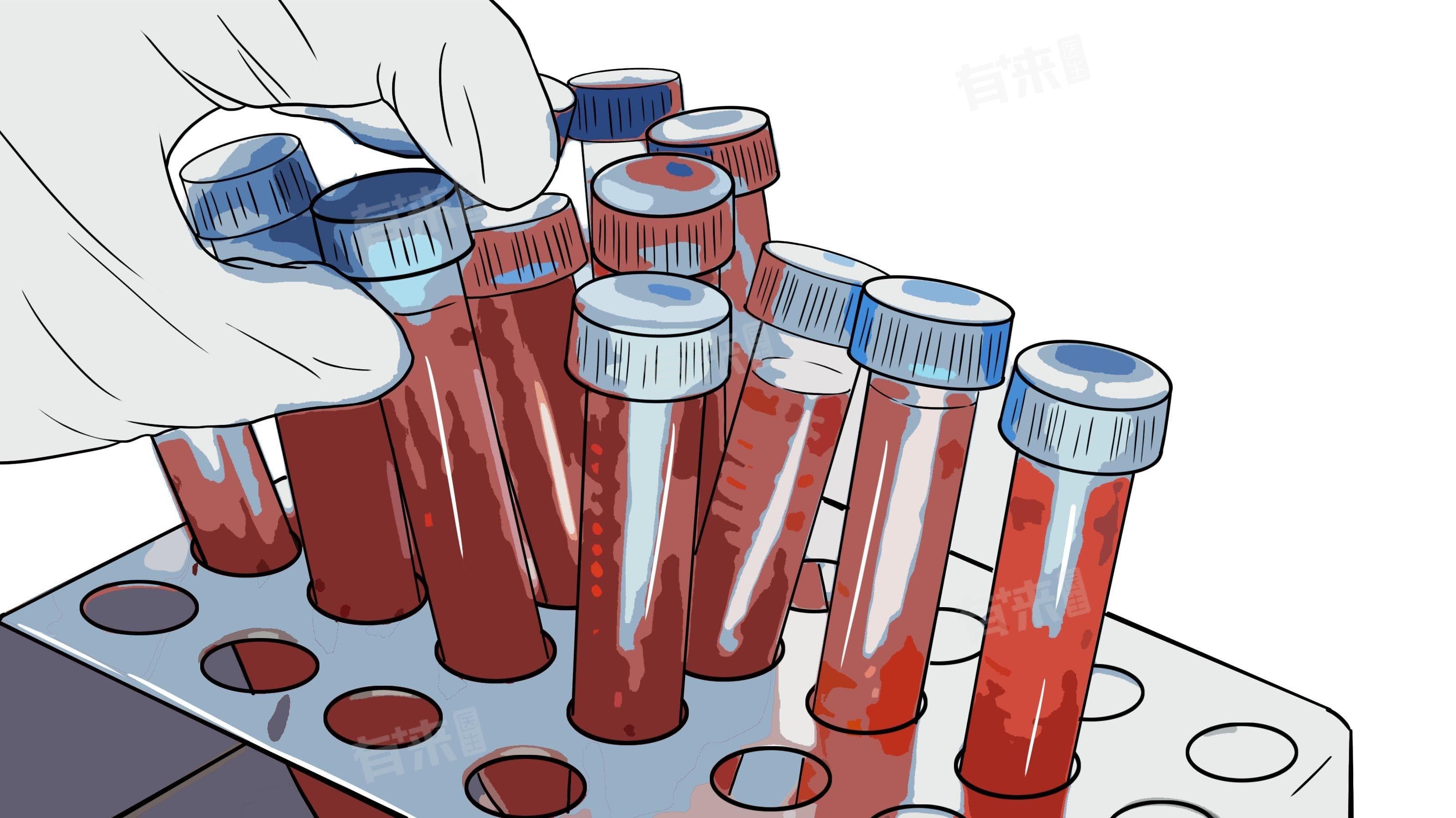 新生儿TSH促甲状腺激素偏高怎么办？原因分析与处理建议