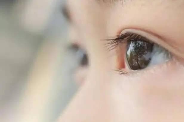 教资体检都对视力有要求，你还觉得视力好坏无所谓吗