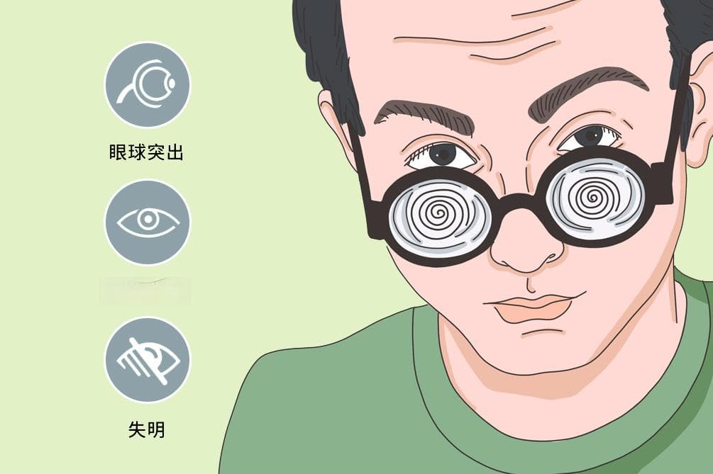 高度近视能不能蹦极？专家解读：这些运动更安全