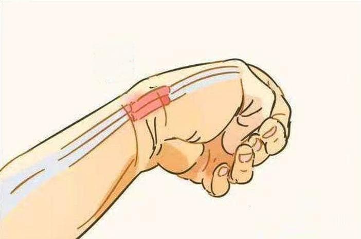 《腱鞘炎的预防与治疗，你知道多少？》