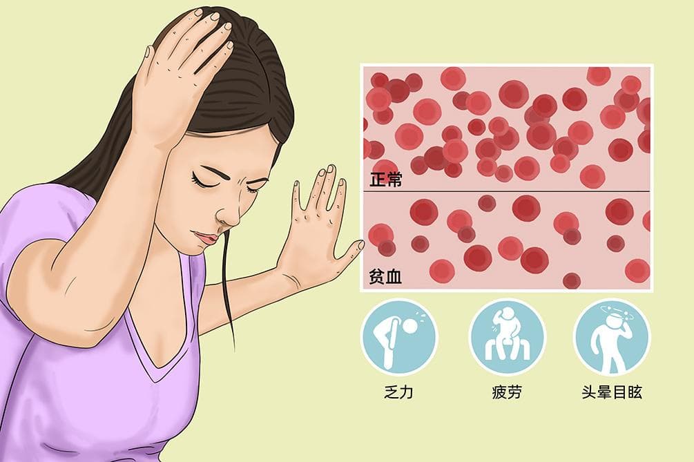 贫血的严重后果及预防措施