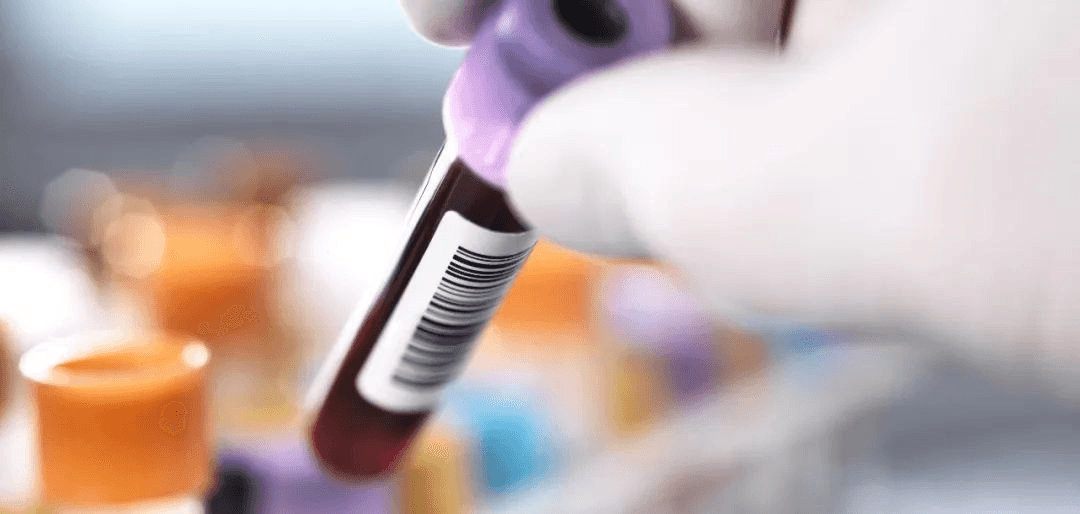 近视手术前为什么要抽血化验？一文读懂术前检查的重要性