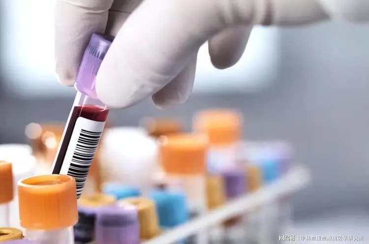 专家提醒：血常规这些指标异常需警惕，可能是血液病早期信号