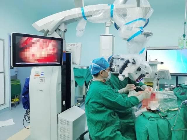 颈动脉狭窄？市中心人民医院神经外科颈动脉内膜剥脱术实现"河道清淤"