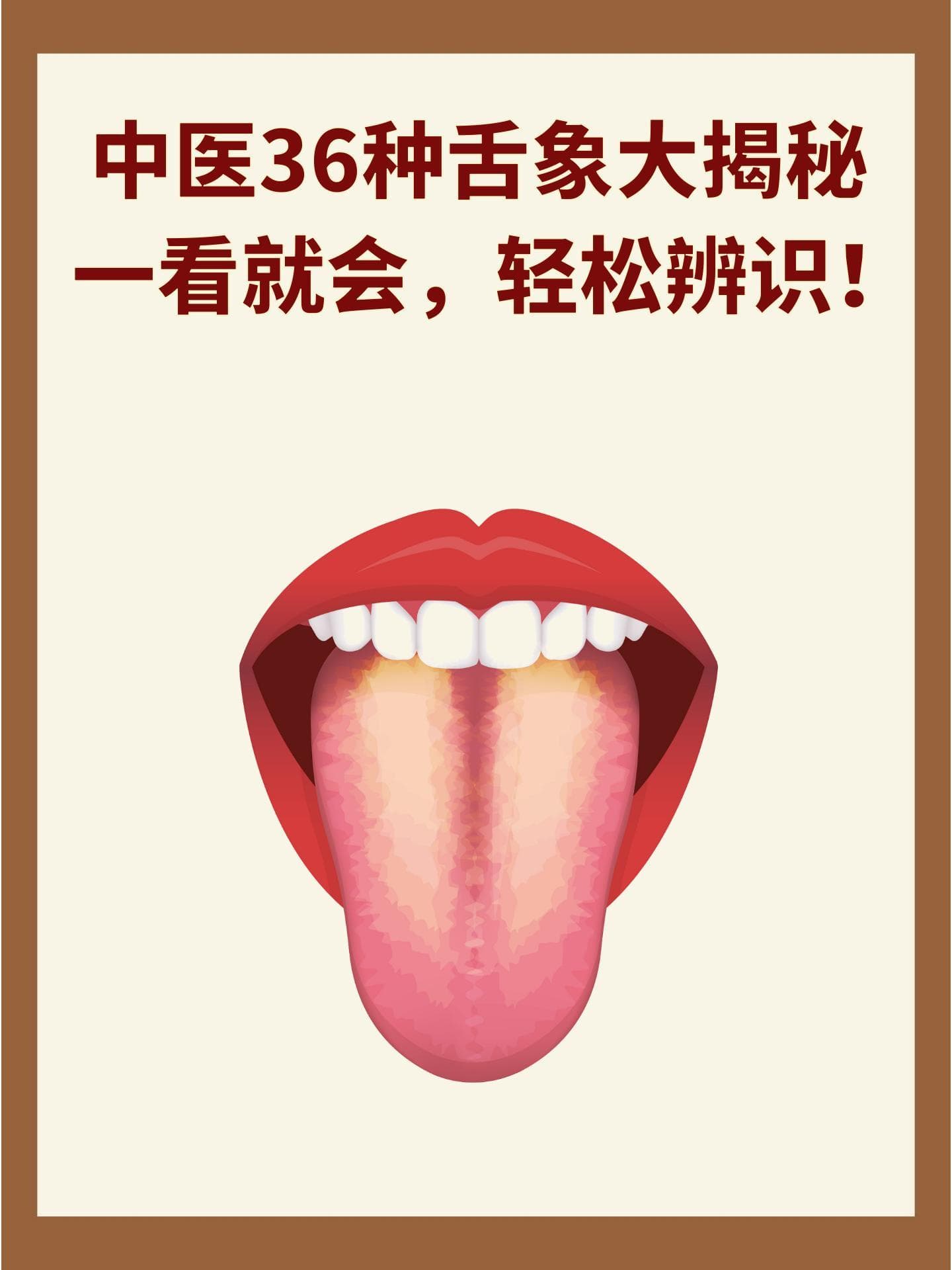 中医36种舌象大揭秘：一看就会，轻松辨识！