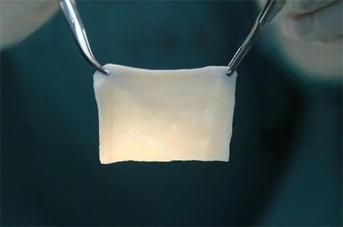 生物补片是什么材料做的？主要是天然材料和合成材料做的