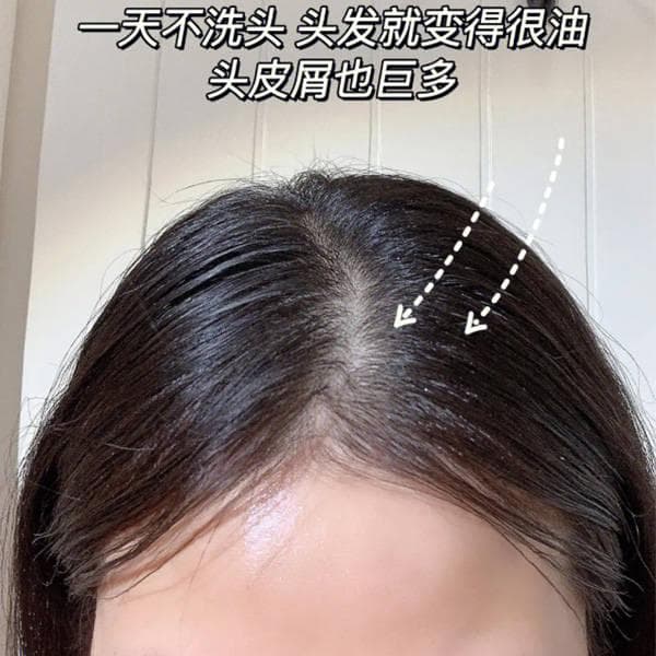 如何选择去屑洗发水？去屑干性头皮洗发水推荐