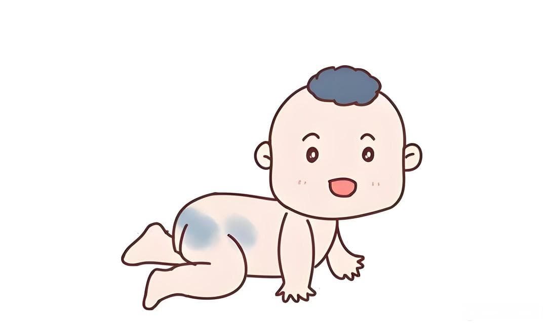新手爸妈必看 | 宝宝身上的青色斑块到底是什么？