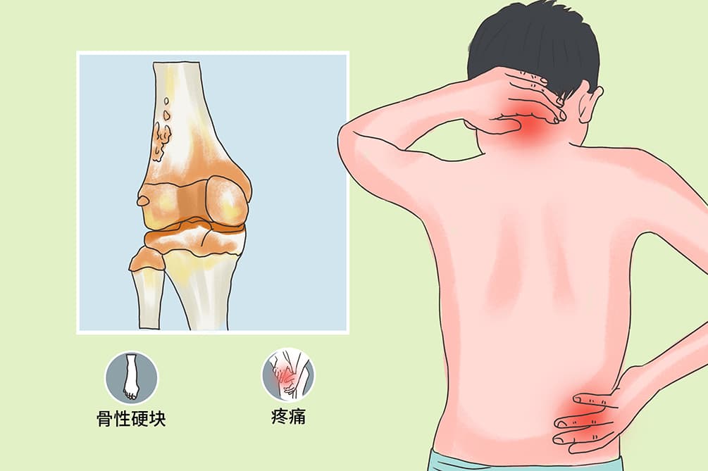 非骨化性纤维瘤：症状、诊断与治疗全解析