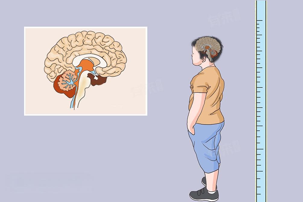 孩子骨龄偏小是好是坏