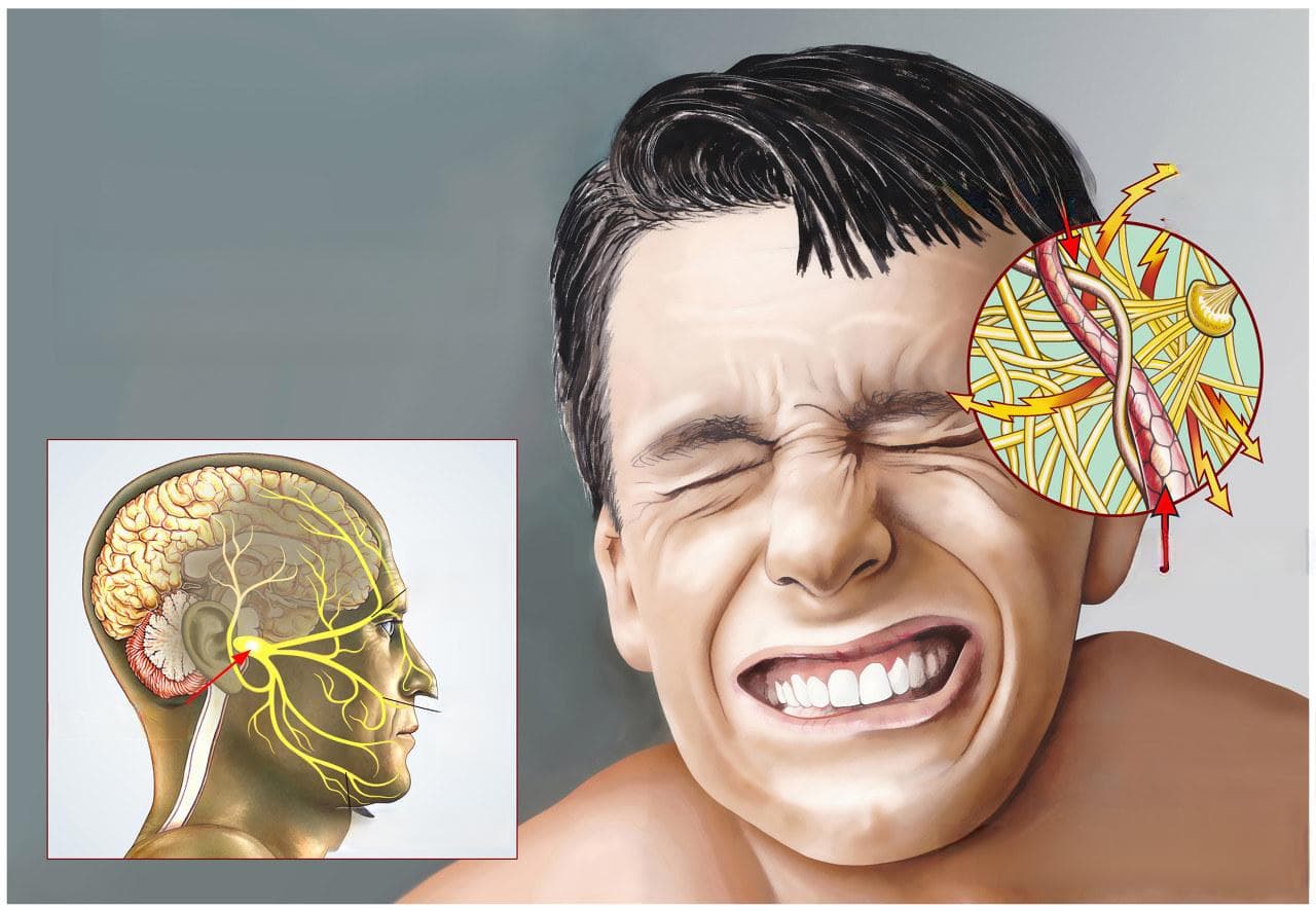 眶上神经损伤的临床症状