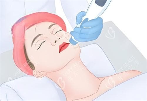 韩女皮肤管理项目全攻略：从专科护理到日常保养，教你如何拥有水嫩肌肤！