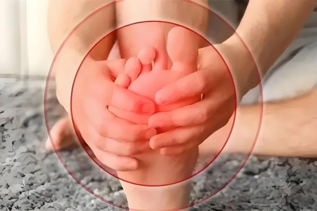 痛风治疗中的"融晶痛"：成因、特点与应对方法