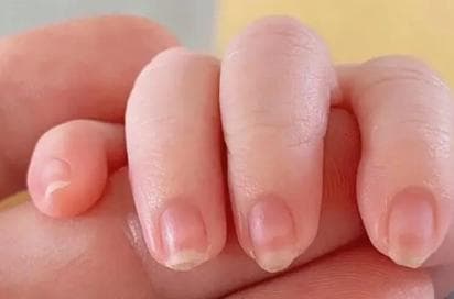 如何正确修剪指甲：方法与注意事项