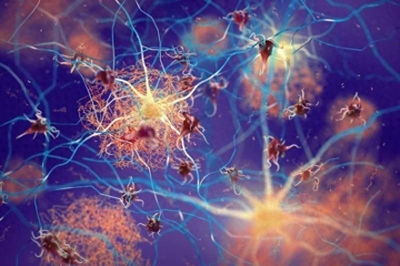 瞄准生物标志物，开发血液检测法，让阿尔茨海默病尽早“现形”
