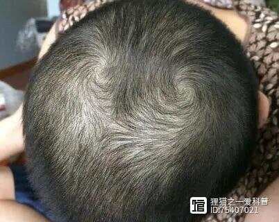 “一旋精，二旋犟”，孩子头顶的旋到底代表什么？科学家给出解释