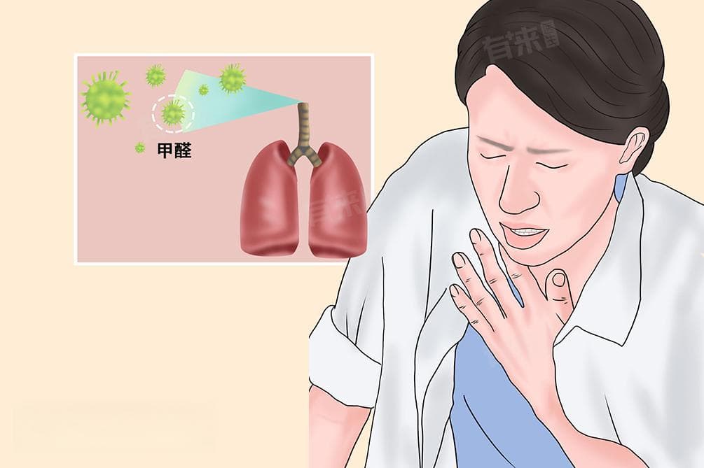 甲醛中毒了怎么办