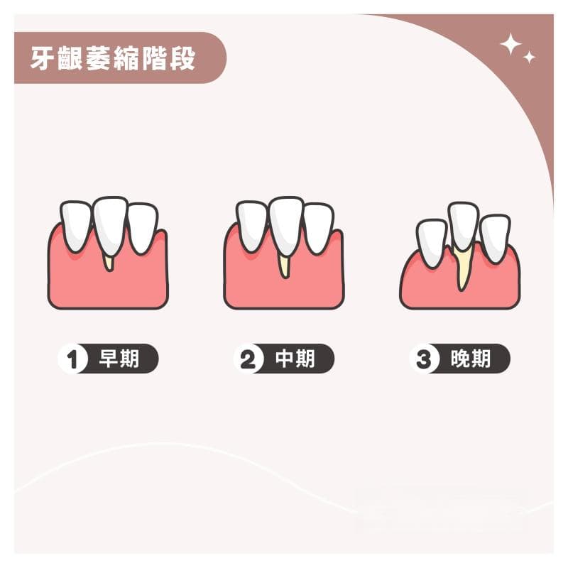 牙龈萎缩的营养改善方案：维C、维D、钙和Omega-3的作用