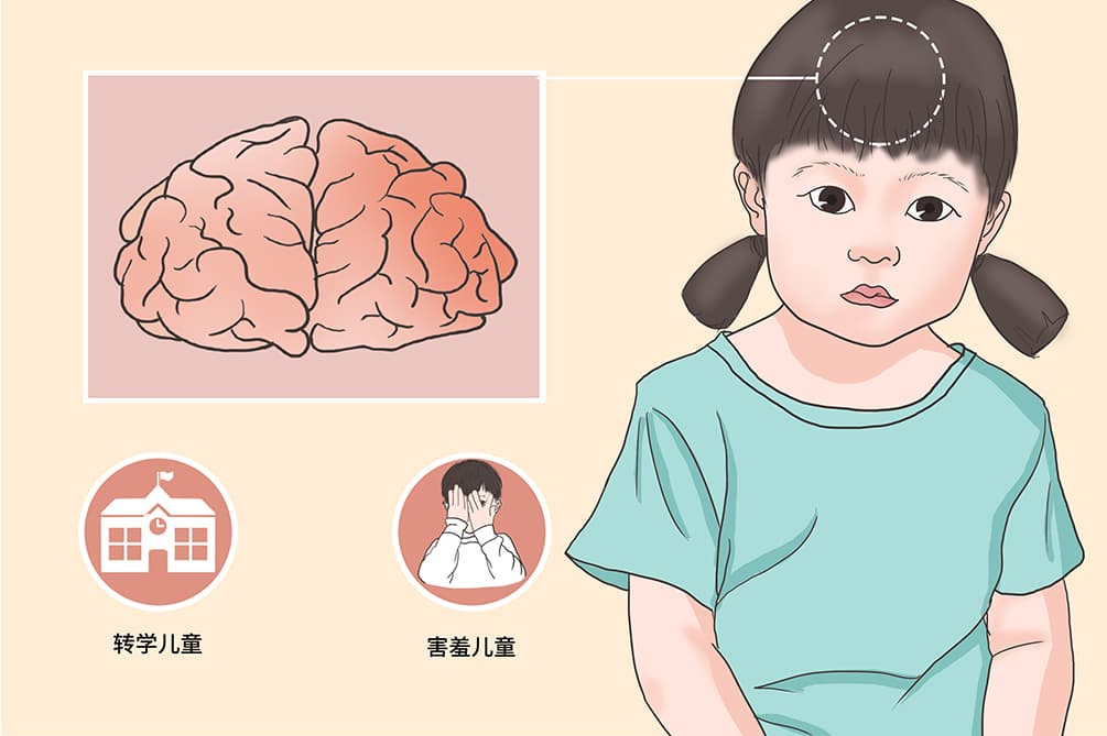儿童选择性缄默症：症状、诊断与治疗全解析