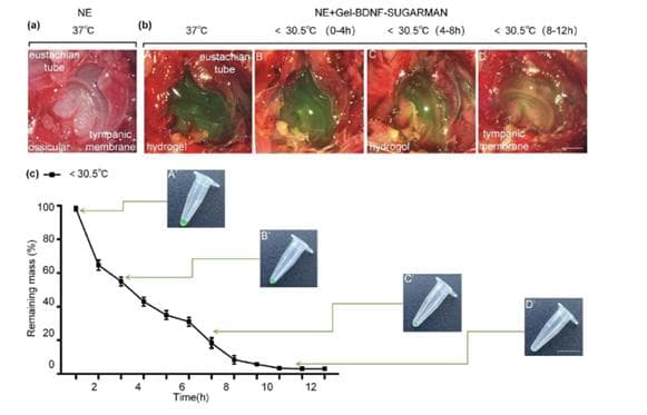 首都医科大学柳柯/清华大学尹斓ACS Nano: 中耳递送载药水凝胶