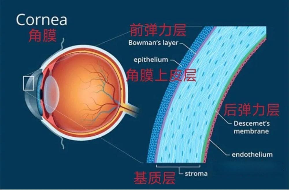 所有人都可以做近视激光手术吗？风险有哪些？一文了解
