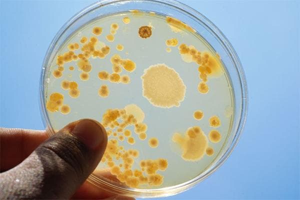 中国批准的7种益生菌盘点，包括短双歧杆菌和乳双歧杆菌
