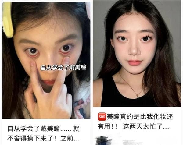 隐形眼镜买不对会伤角膜！