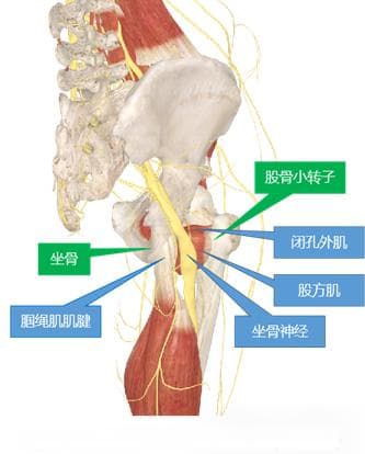 髋部之痛：坐骨 - 股骨撞击综合征