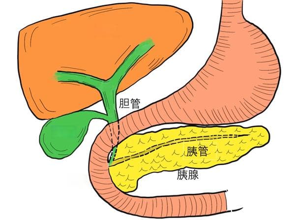 胆囊切除手术会影响寿命吗？这些后遗症需警惕