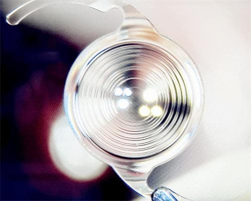 白内障救助基金如何申请?白内障补助2025年新消息公布!