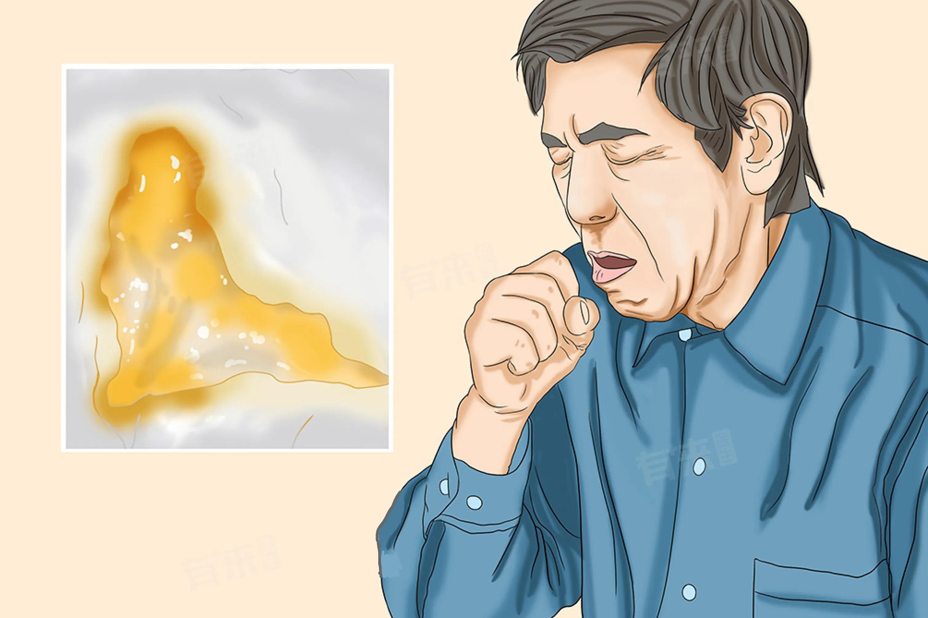 有黄痰是风热还是风寒