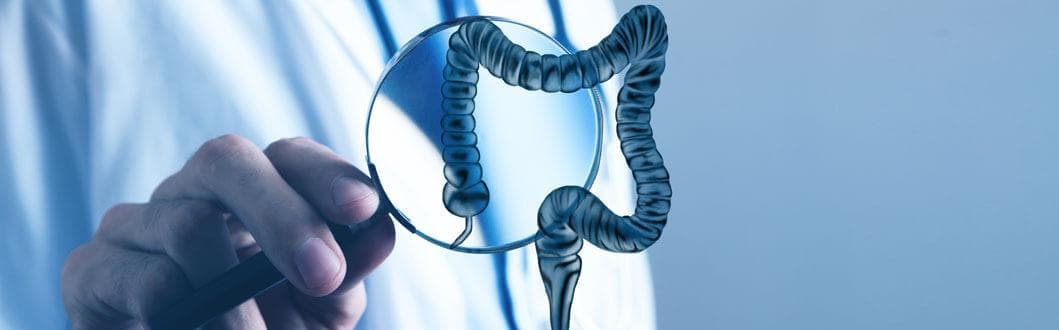 克罗恩病：症状、诊断与治疗全解析