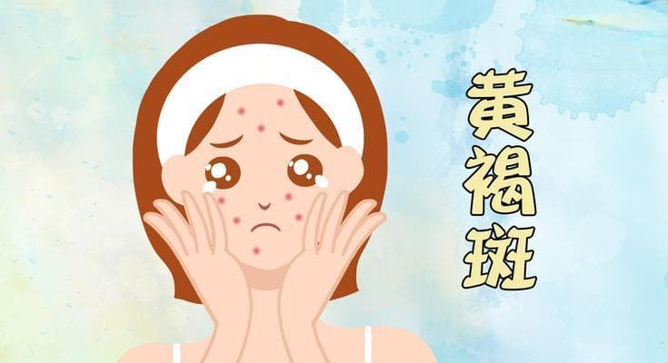 黄褐斑的原因及预防方法（揭秘黄褐斑形成的原因与有效预防方法）