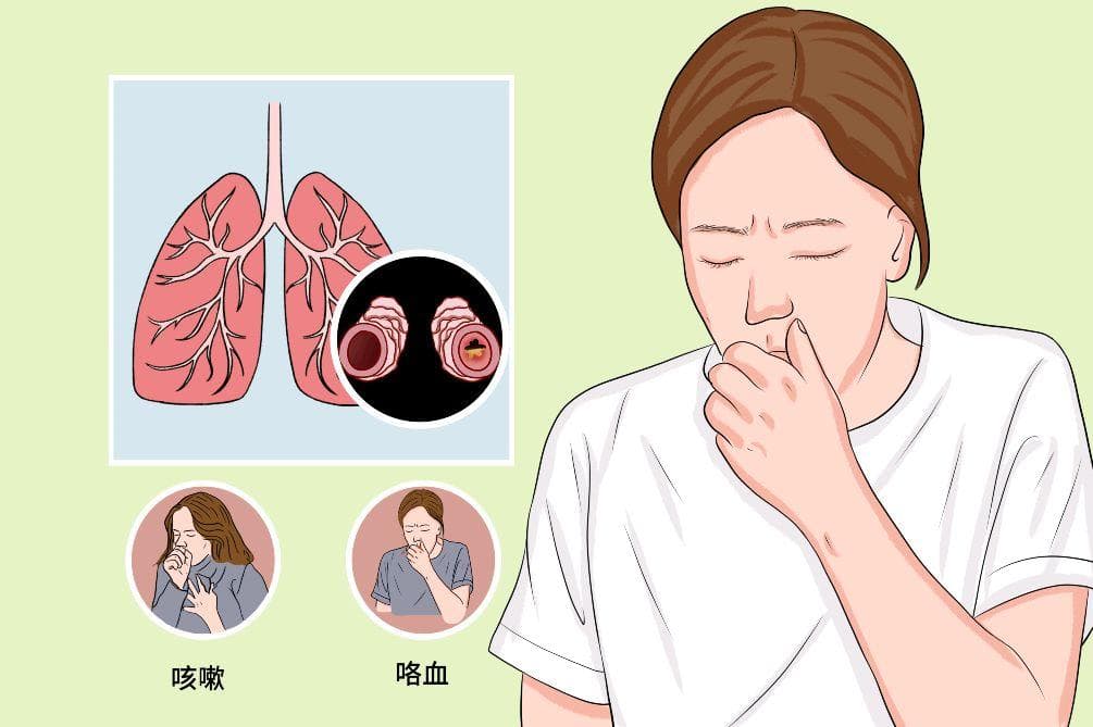 健康养生保健是支扩稳定的关键