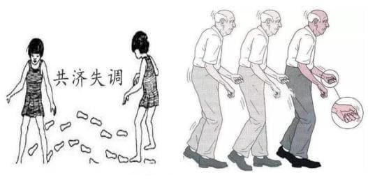 谈“晕”色变，带你认识脑梗相关的中枢性眩晕