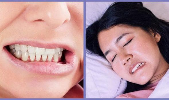 磨牙症（牙齿磨损）：症状、原因与治疗方法