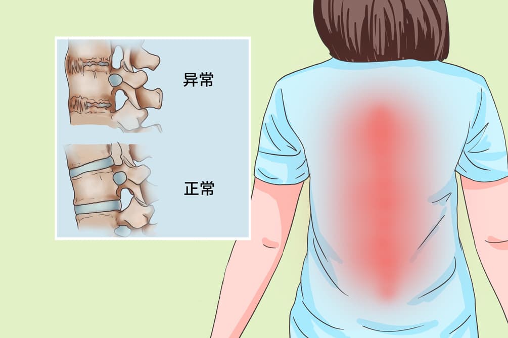 强直性脊柱炎怎么检查确认