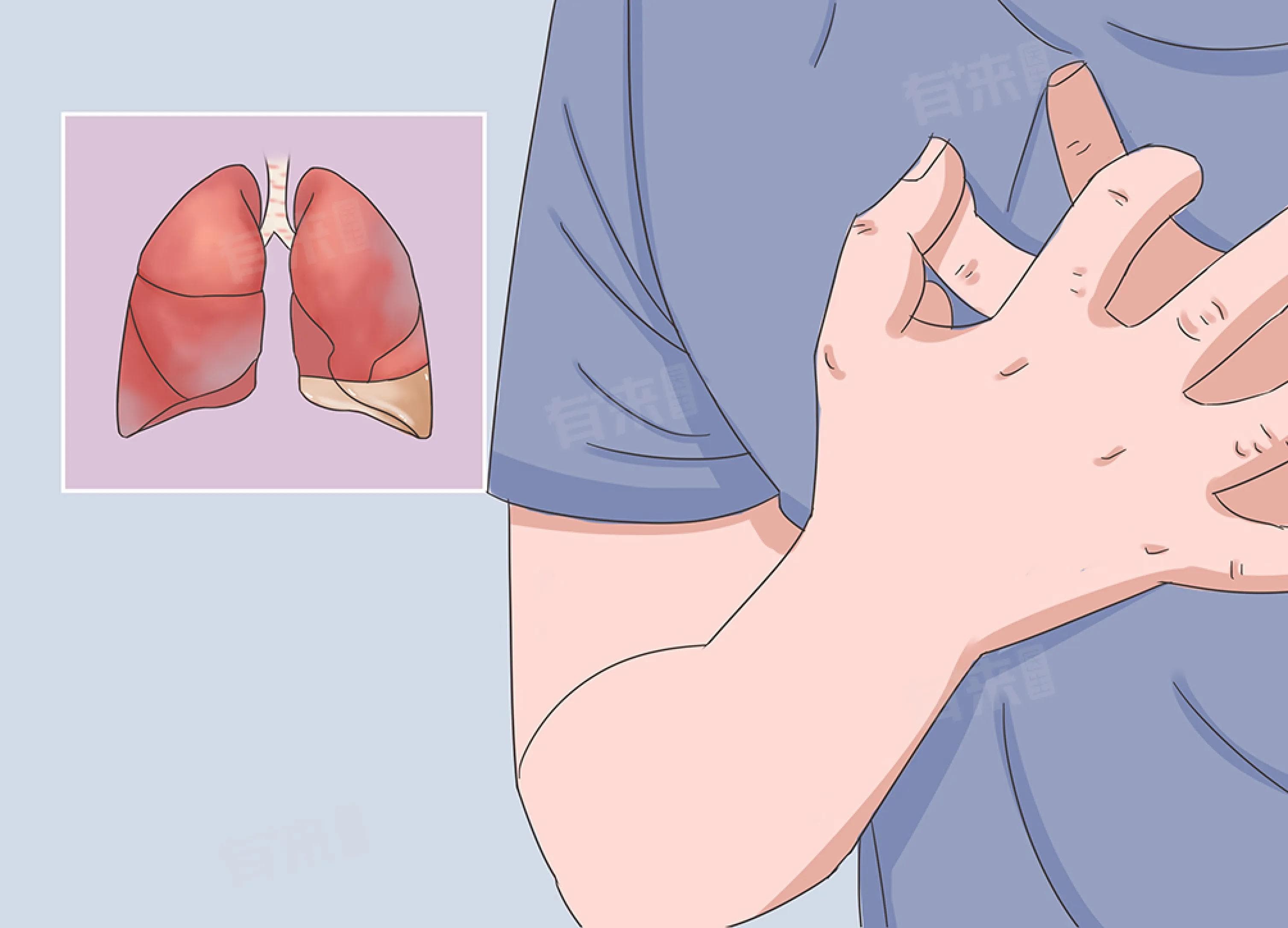 胸腔有积液严不严重