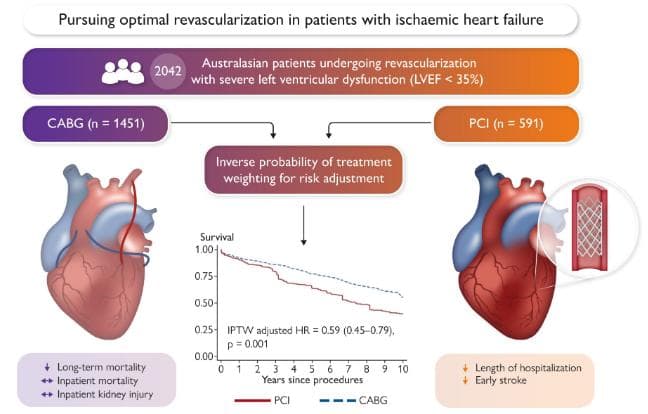 Eur Heart J：缺血性心肌病患者CABG和PCI治疗对长期生存率的比较