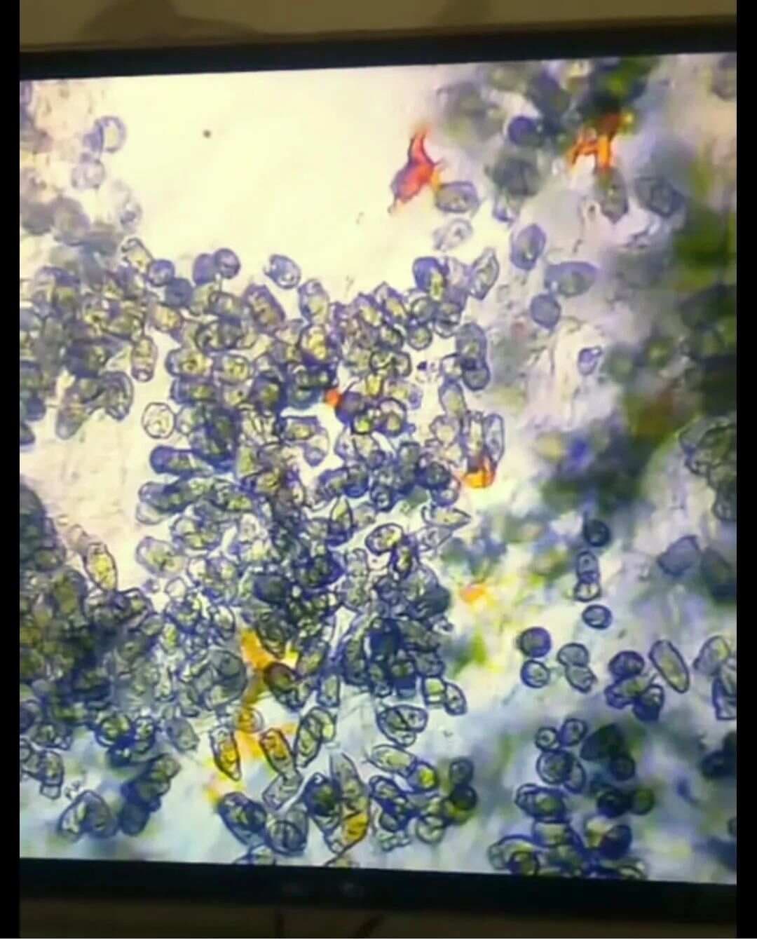 海水虾蟹养殖中纤毛虫的处理