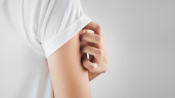 湿疹的症状、病因及治疗方法全解析